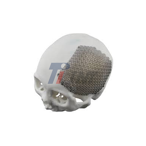 titanium mesh plate skull factory titanium mesh plate skull factory