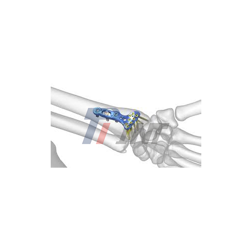 titanium humerus plate supplier titanium humerus plate supplier
