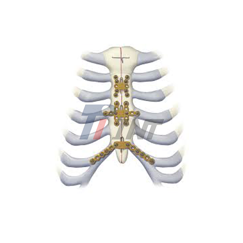 titanium bars in chest supplier titanium bars in chest supplier