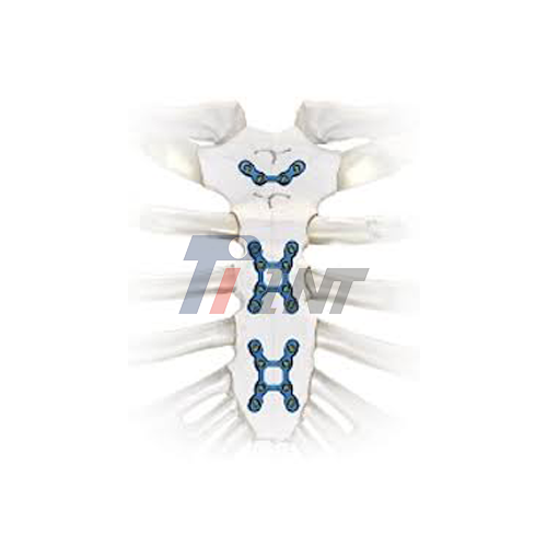 titanium plate heart surgery titanium plate heart surgery