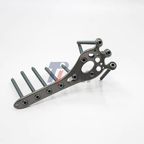 titanium plate implant