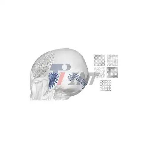 titanium plate brain surgery