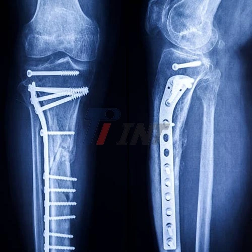 medical titanium plate medical titanium plate