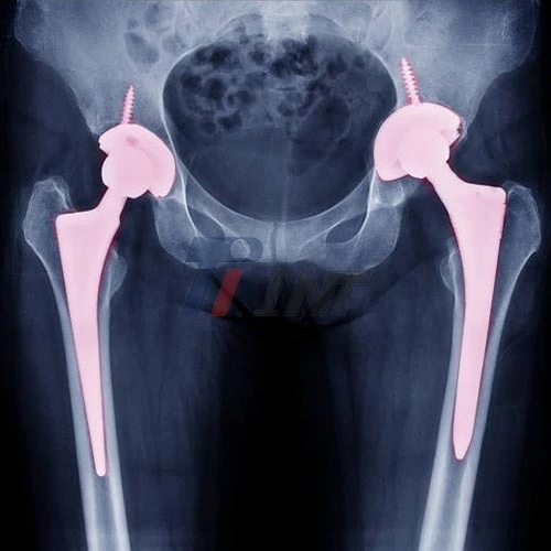 medical titanium plate