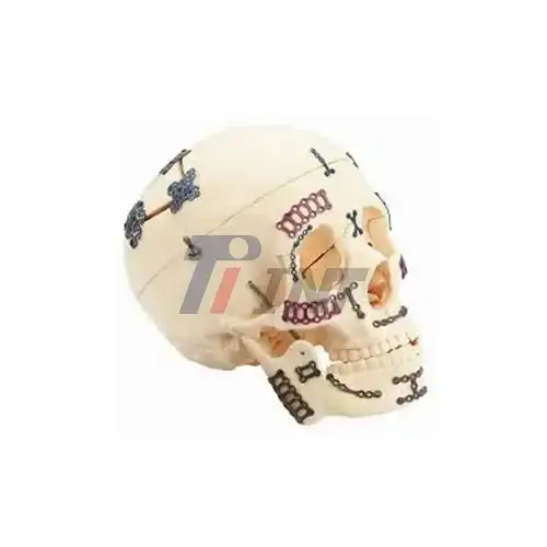 titanium plate for facial fracture