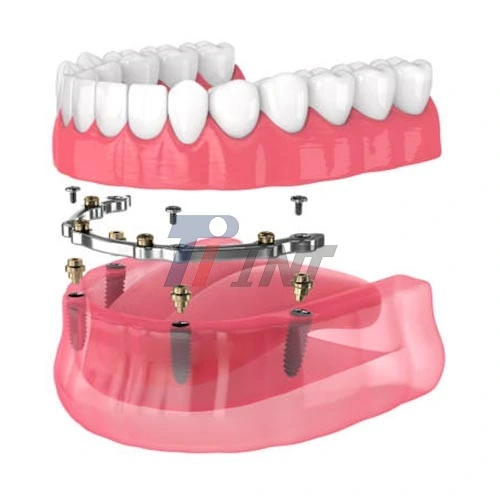 dental implant titanium bar dental implant titanium bar