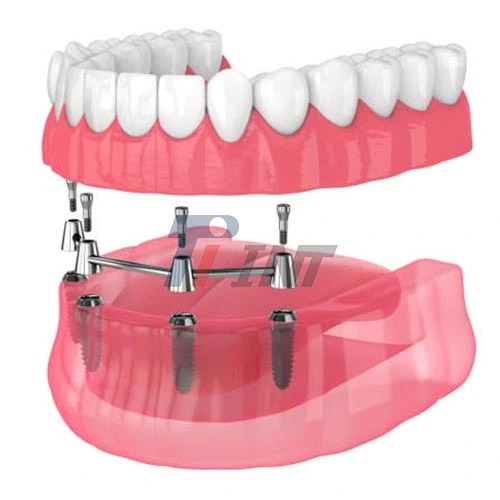 titanium bar dental