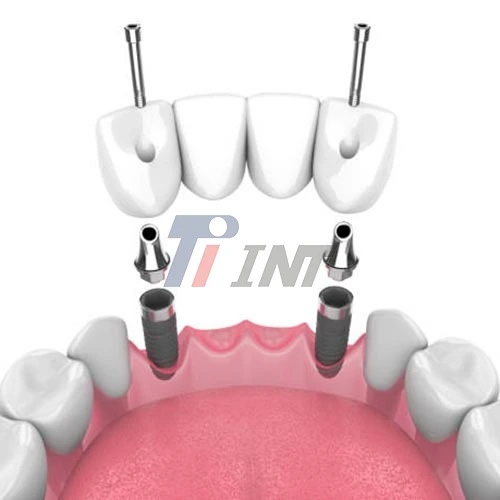 titanium bar for medical use
