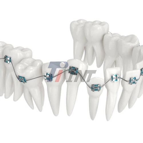 milled titanium bar dental