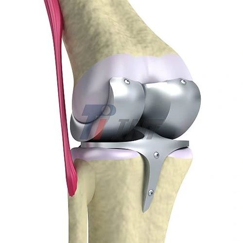 medical titanium plate