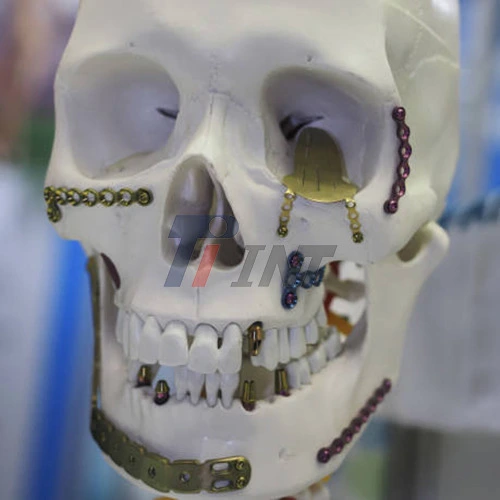 maxillofacial surgery titanium plates maxillofacial surgery titanium plates