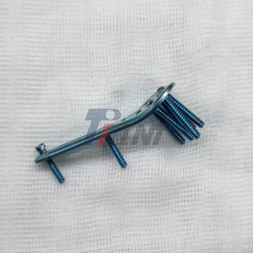 titanium plate for broken wrist