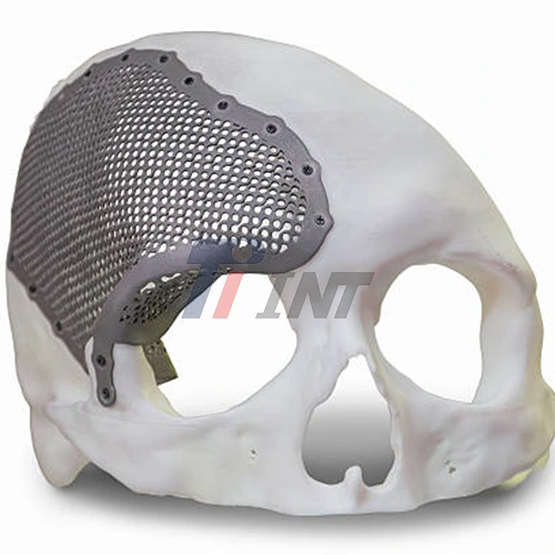 cranioplasty titanium plate