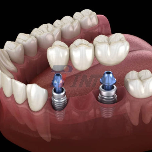titanium bar for dental implants