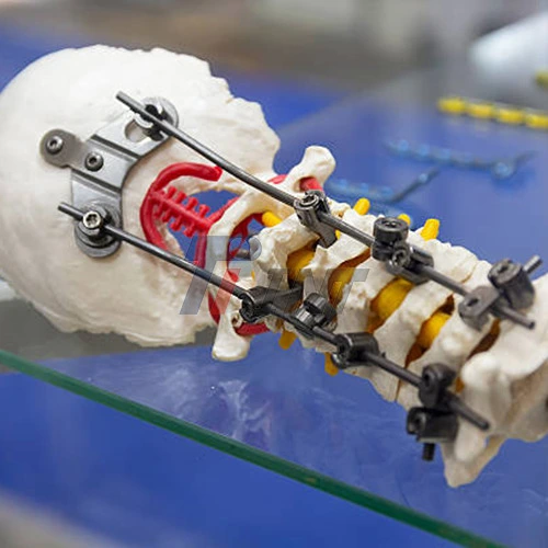 medical titanium bar medical titanium bar