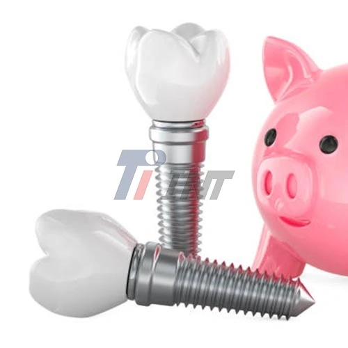 titanium implant bar