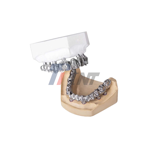 titanium bar dental implants