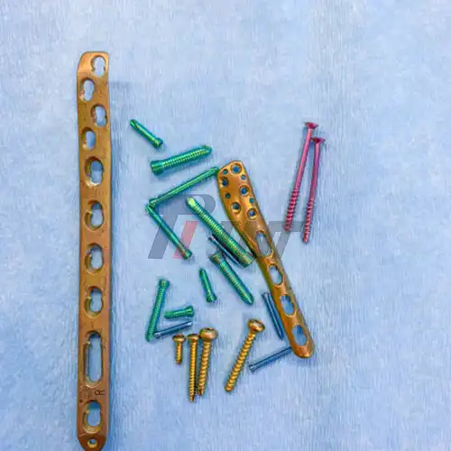 titanium bars in chest titanium bars in chest