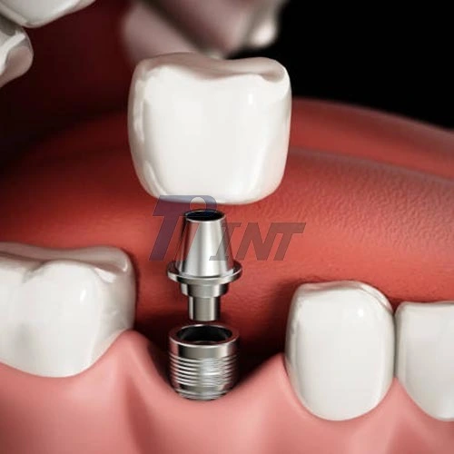 Gr1 Titanium Medical Bar