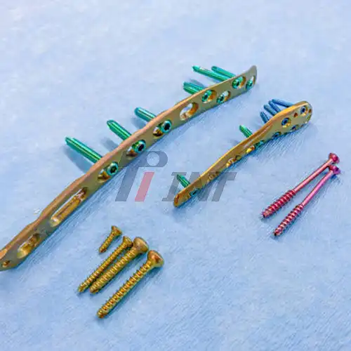 titanium bars in chest
